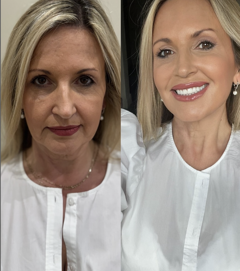 Skin SOS Before & After 1