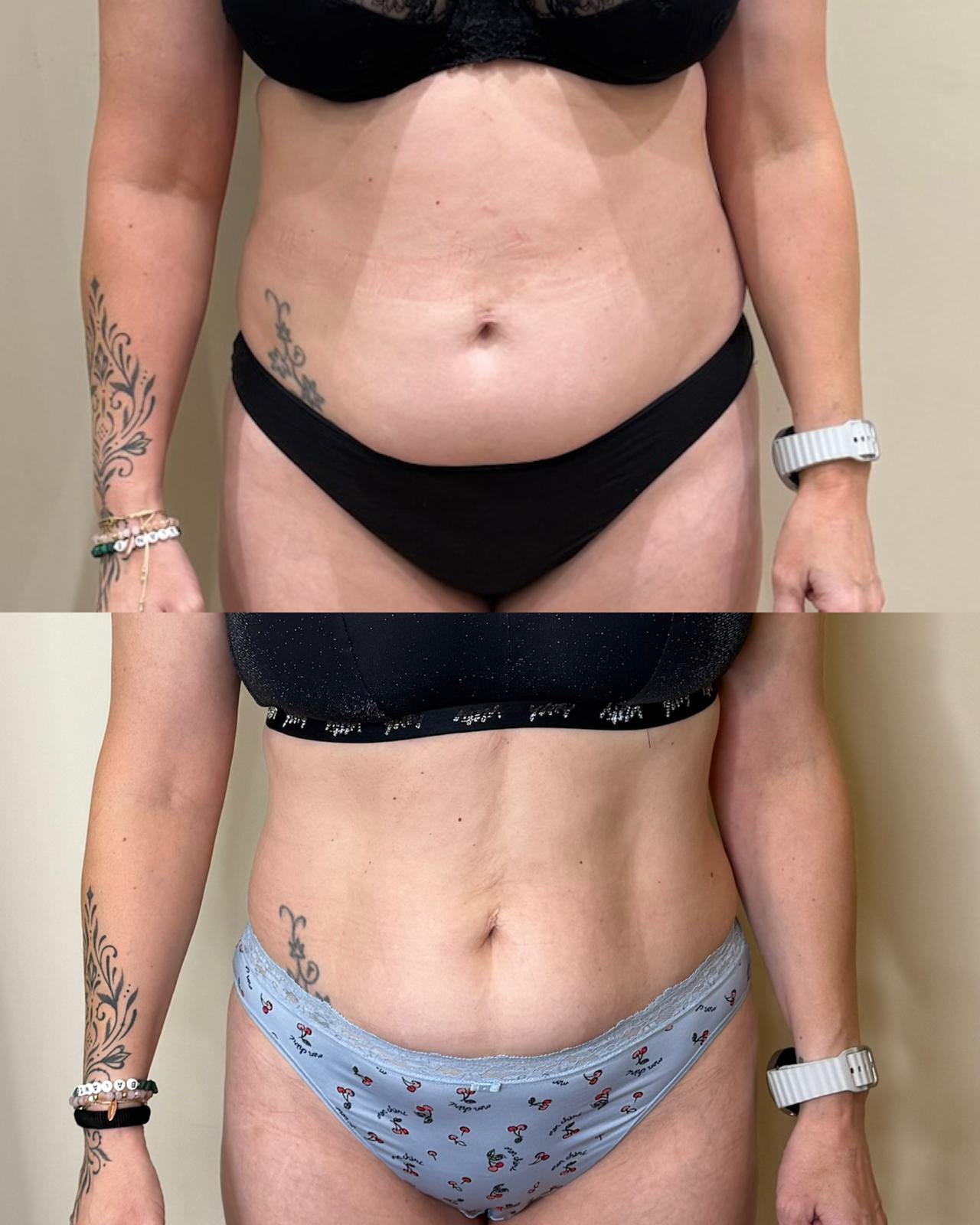 Skin SOS Before & After 3