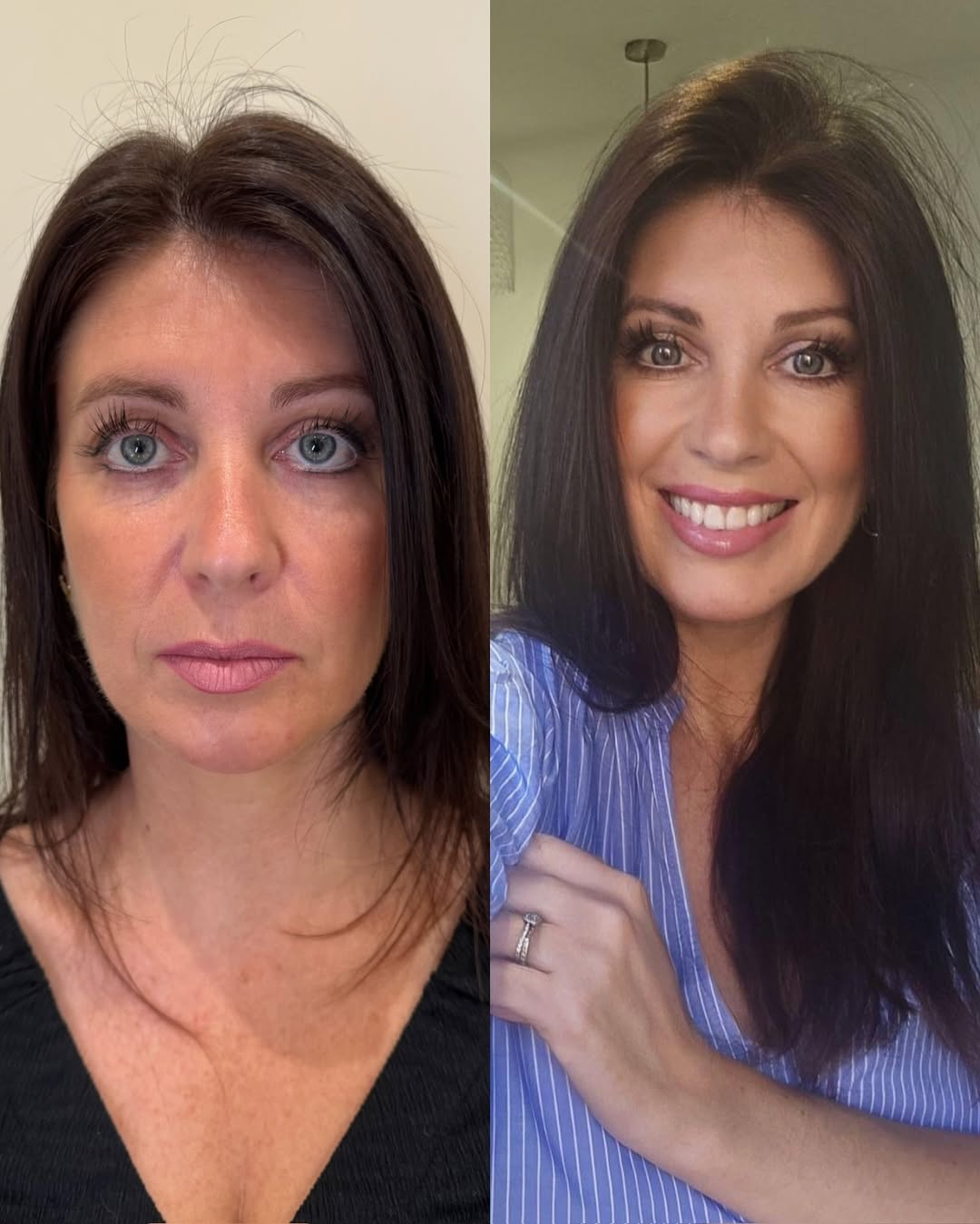 Jennifer's transformation - before and after