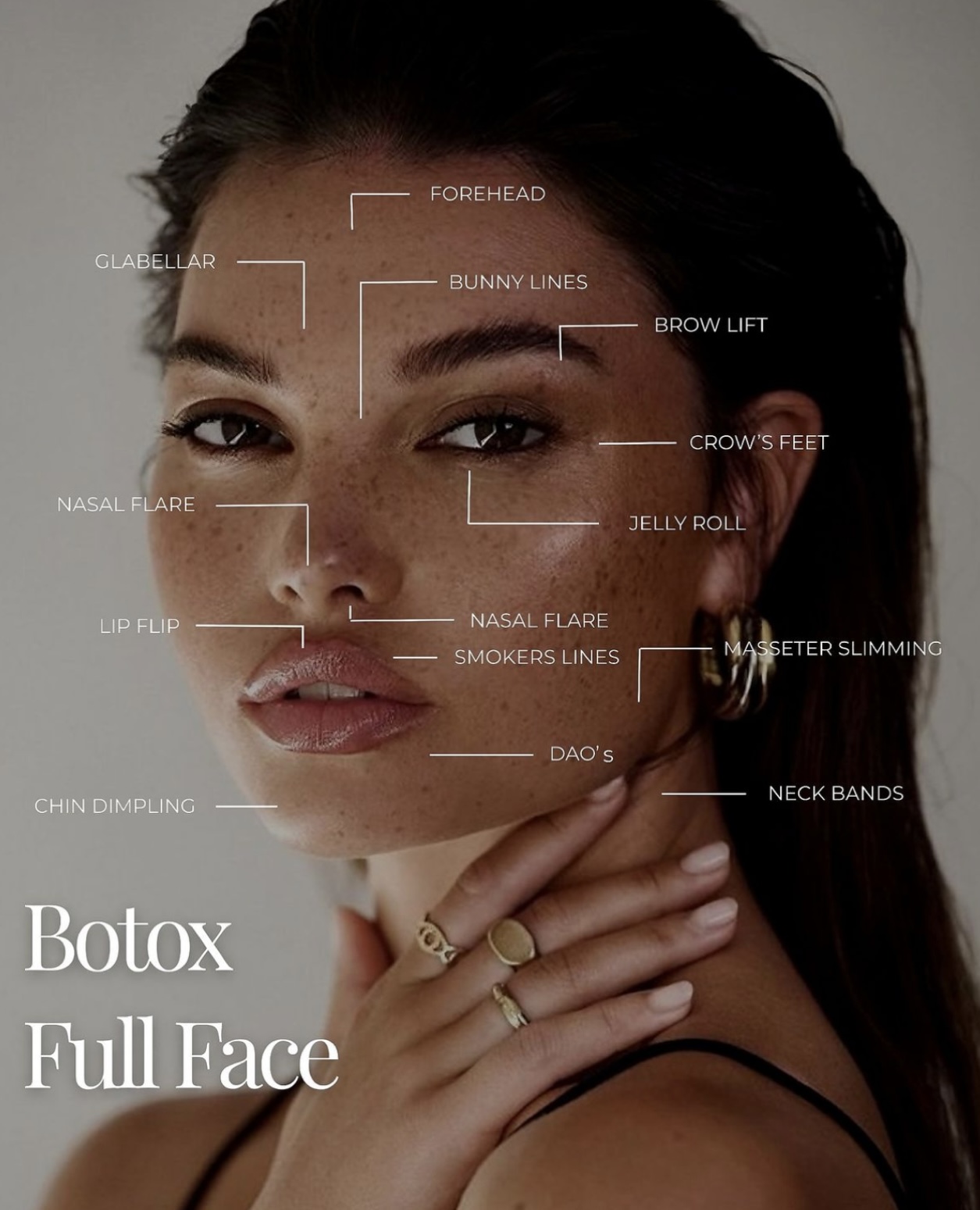 Anti-wrinkle treatment areas - full face