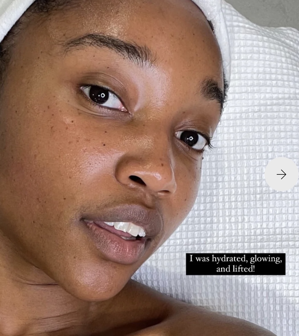 Tri Facial glowing lifted results