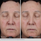 Obagi Lift Up and Sculpt