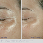 Obagi Elastiderm Eye Cream