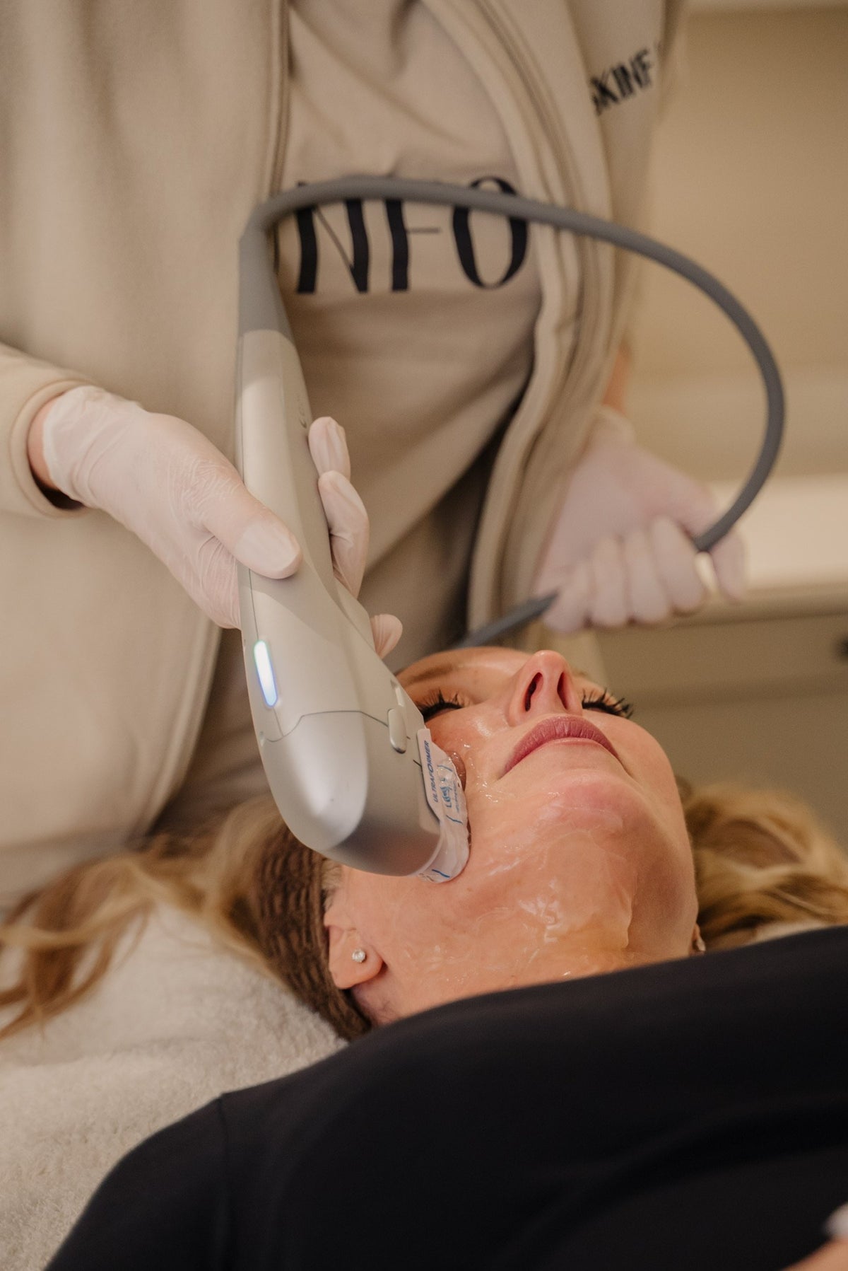 HIFU treatment on the face at Skinfolk using the Ultraformer handpiece